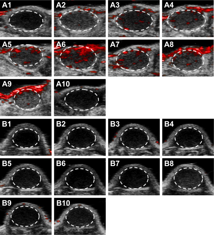 Figure 15