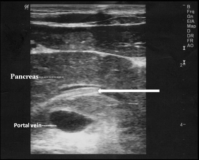 Fig. 9