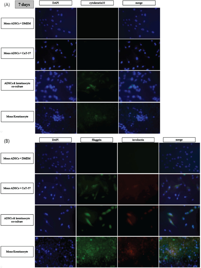 iwj-12335-fig-0004-c