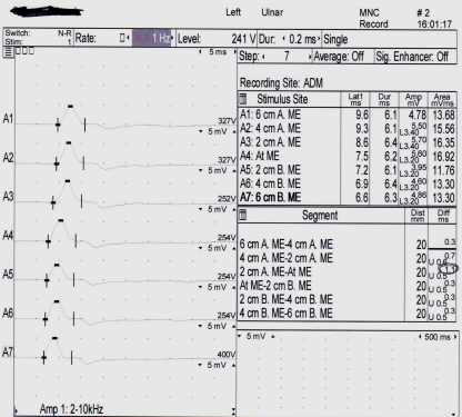 Figure 4