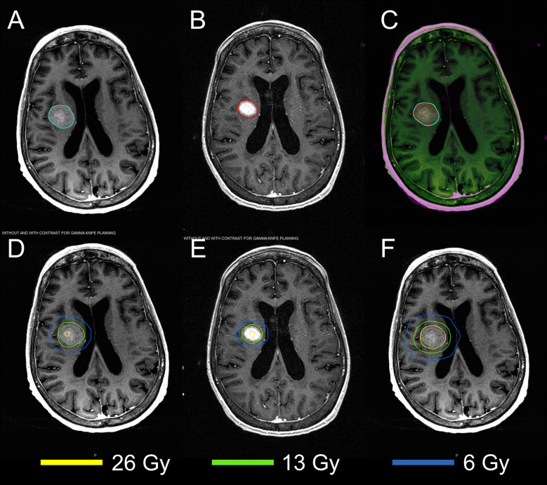 Figure 2