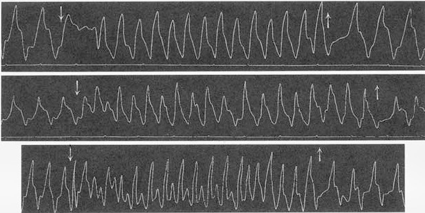 Fig. 17