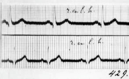 Fig. 38