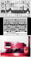 Fig. 28