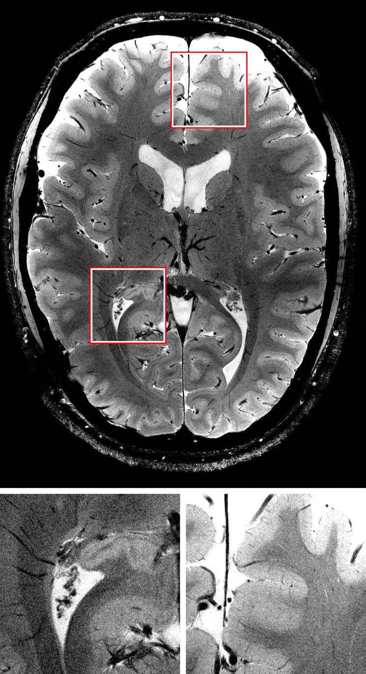 Fig 6