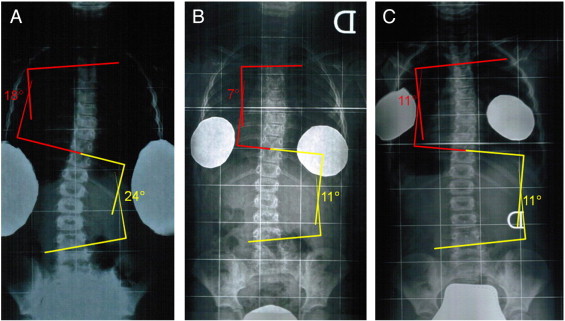 Fig 2