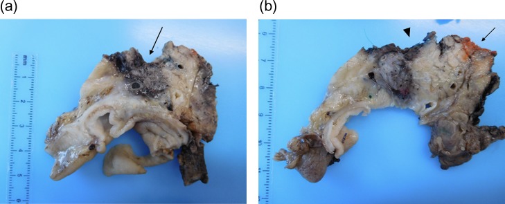 Figure 4: