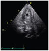 Figure 1: