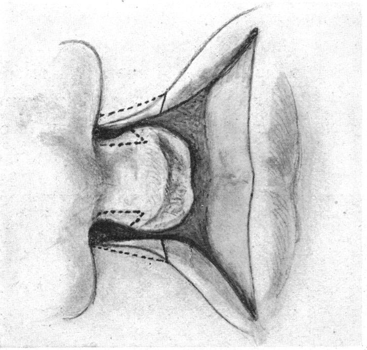 FIG. 18.