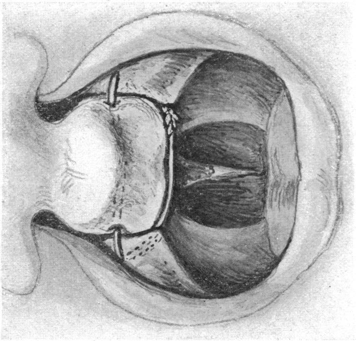 FIG. 19.