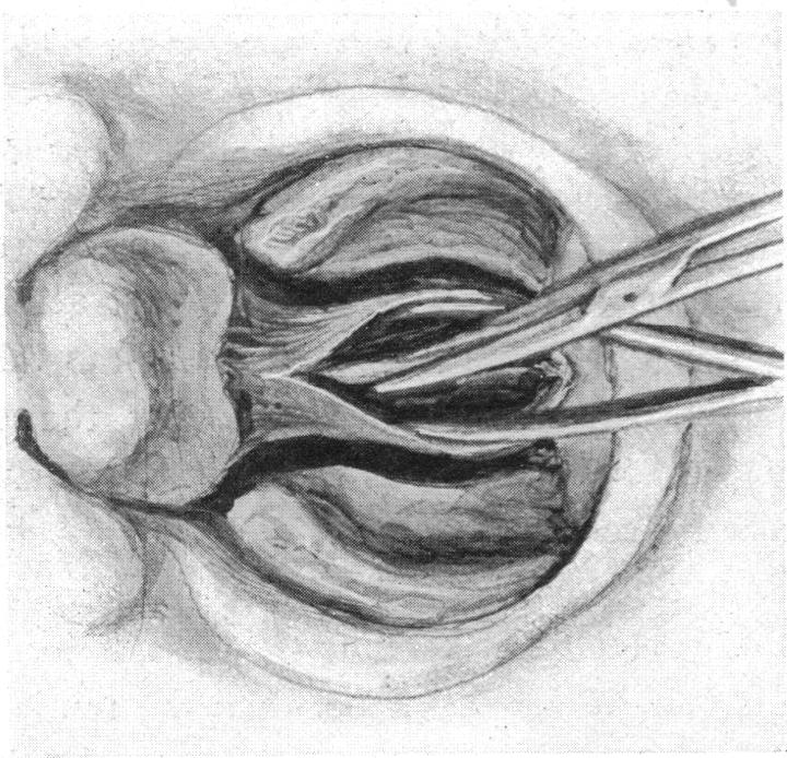 FIG. 20.