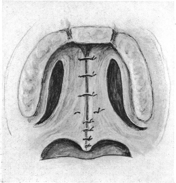 FIG. 30.