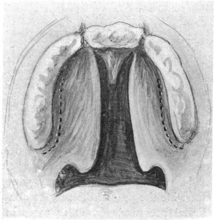 FIG. 28.