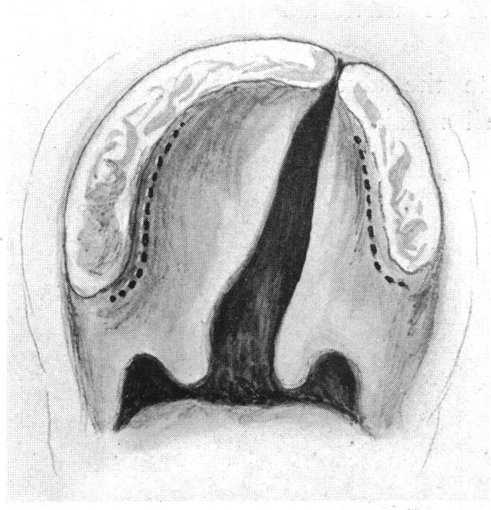 FIG. 25.