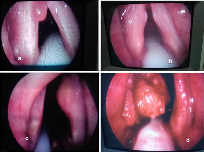 Fig. 1