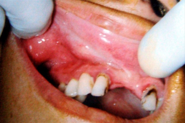 Fig. 2