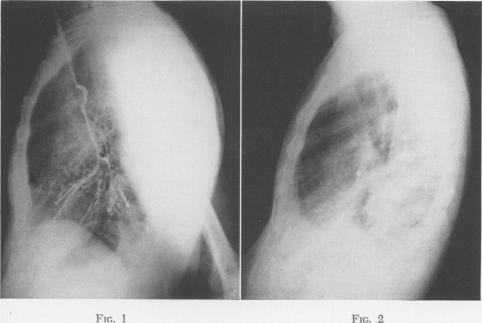 Fig. 1., Fig. 2.