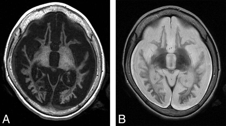 Fig 1.