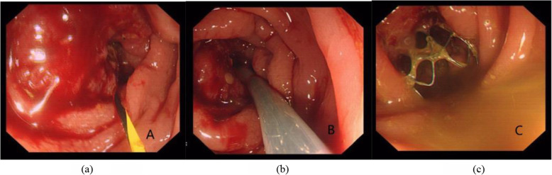 Fig. 2