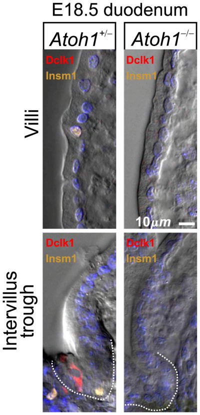 Fig. 18