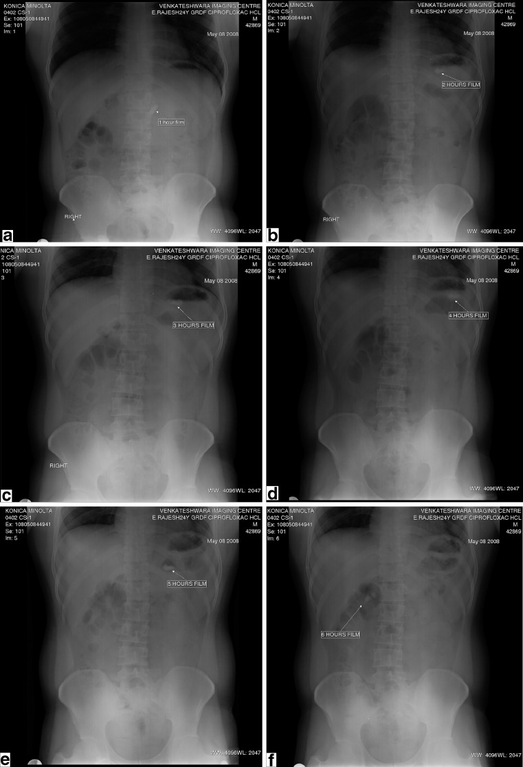 Fig. 4