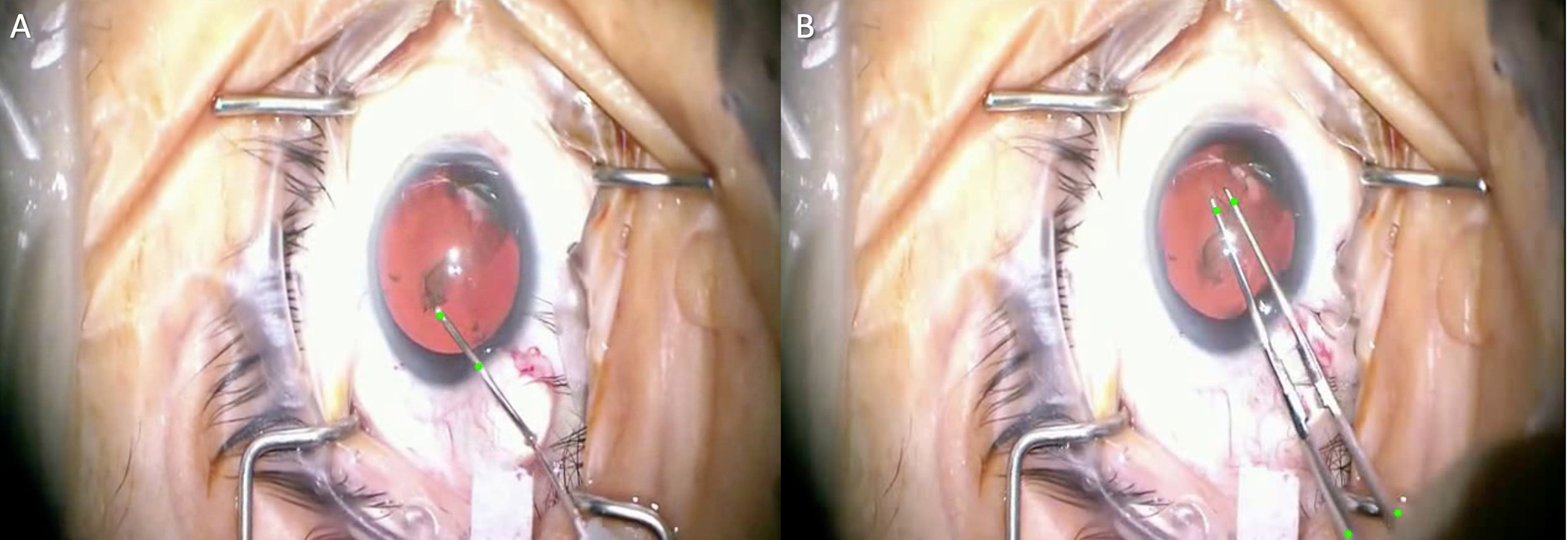 Figure 1: