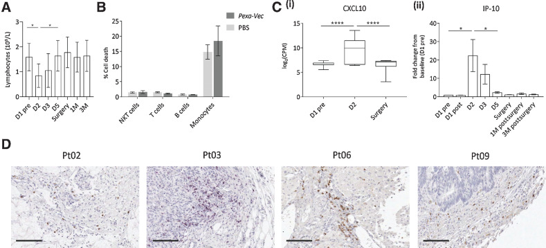 Figure 4. Chemokine expression and CD8+ T-cell tumor infiltration. A, Trial patient peripheral blood lymphocyte concentrations prior to [day (D)1 pre] and post-Pexa-Vec infusion [M: month(s)]. *, P < 0.05 by paired t test; n = 9. B, Cell death of healthy donor PBMC populations treated with Pexa-Vec or PBS (n = 3). C, Pexa-Vec–treated trial patient PBMCs were assessed for (i) mRNA expression of CXCL10. Padj value was determined after using the Benjamini and Hochberg method for controlling FDR; ****, P < 0.0001; n = 7). (ii) Multiplex quantification of CXCL10 protein (IP-10) in trial patient plasma. *, P < 0.05 by paired t tests; n = 9. All data are shown as mean ± SEM. D, IHC staining (brown) of CD8-expressing cells within representative trial patient tumors following Pexa-Vec infusion. Bars, 100 μm.