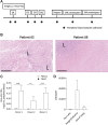 Figure 1. Pexa-Vec peripheral blood carriage. A, Trial schema showing the timing [day (d); month (M)] of Pexa-Vec infusion and collection of translational blood samples. B, H&E staining of tumor sections from patients 05 and 08 showing areas of necrosis. “L” indicates lymphocytic infiltrate. Bars, 400 μm. C, qPCR quantification of Pexa-Vec in the plasma or PBMCs of three healthy donors following ex vivo addition of virus to whole blood. Data are shown as mean + SEM ng DNA in PBMCs or plasma extracted from an initial 5 mL peripheral blood. **, P < 0.01; ***, P < 0.001 by unpaired t tests; n = 9. D, Neutralizing antibodies to Pexa-Vec in patient serum following intravenous infusion. Plot shows mean + SEM pre-virus, peak at surgery/1M after and end of study titers in n = 9 patients.