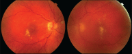 Fig 1.