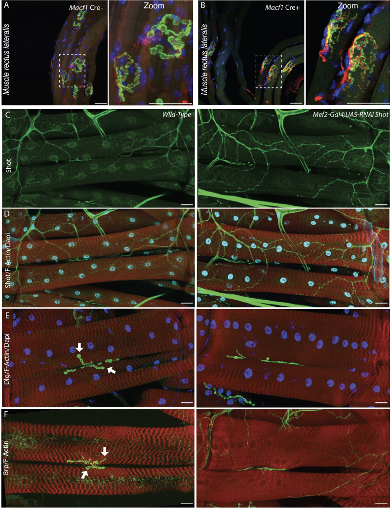 Figure 5—figure supplement 1.