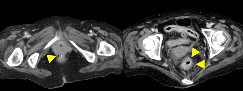 Fig. 5