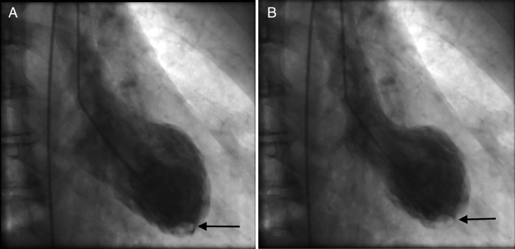 Figure 3: