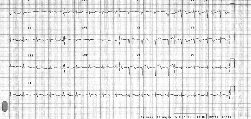 Figure 1: