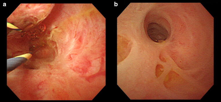 Fig. 11