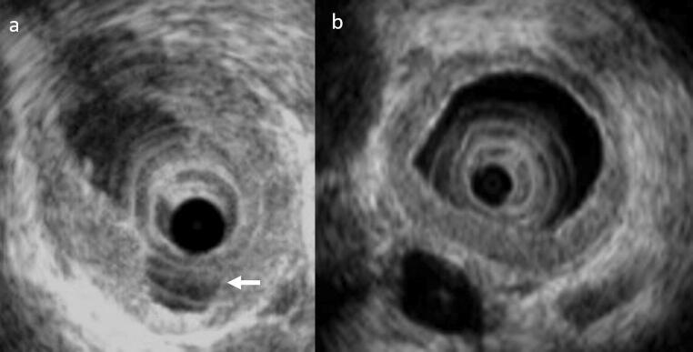 Fig. 10