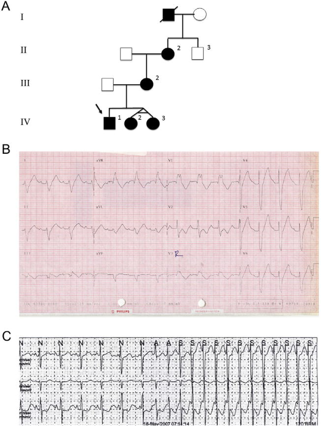 Fig. 1