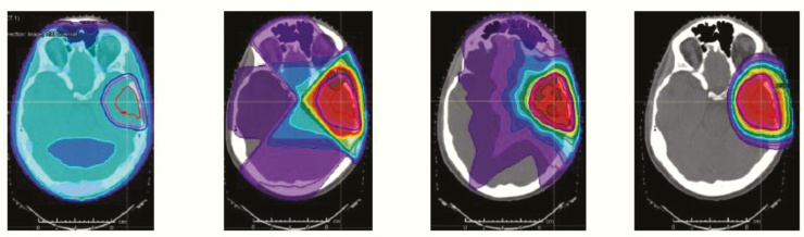 Fig. 9