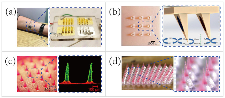 Figure 11