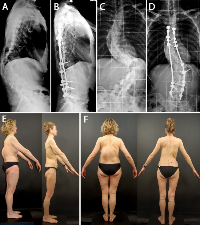 Fig. 6