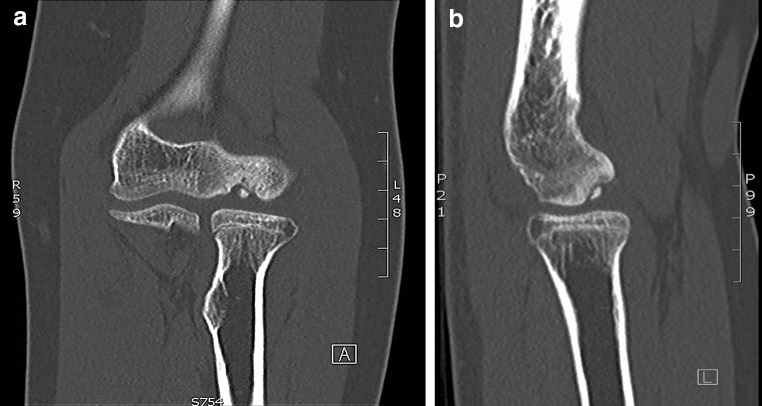 Fig. 1