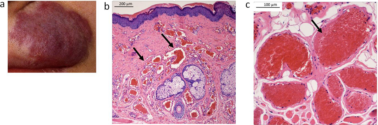 Fig. 1: