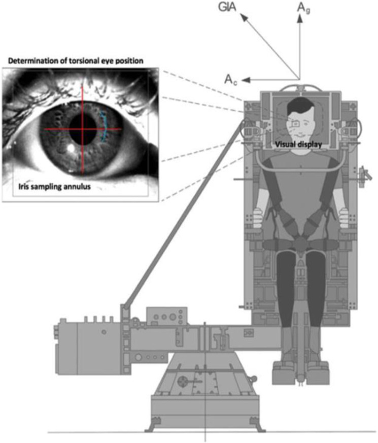 Fig. 2