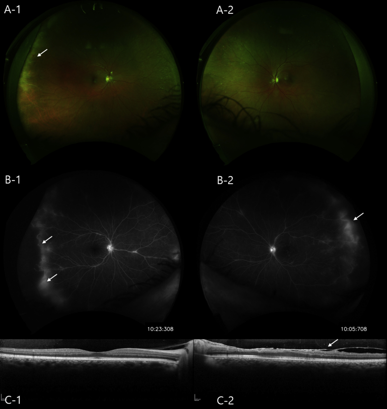 Fig. 2