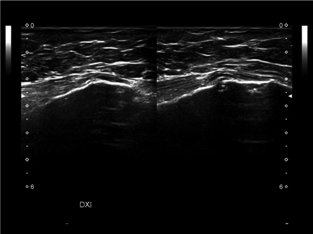 Fig. 11