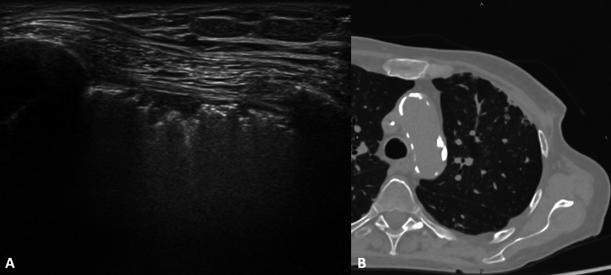 Fig. 12