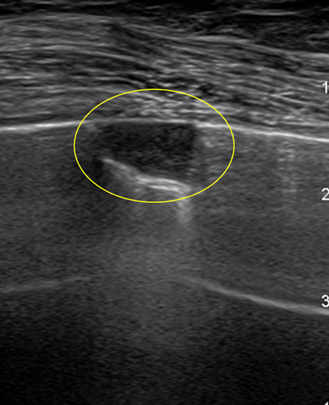 Fig. 13