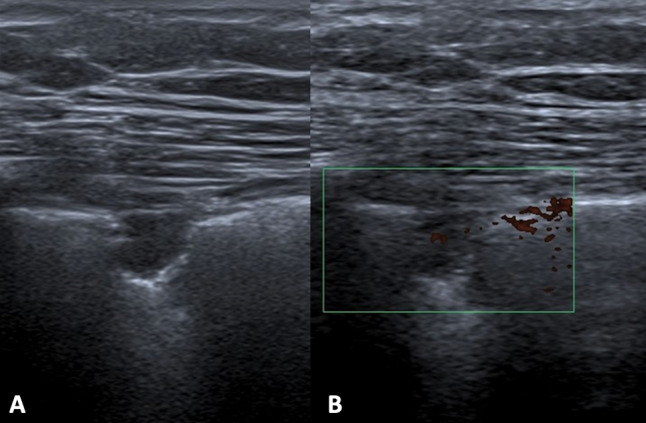 Fig. 14