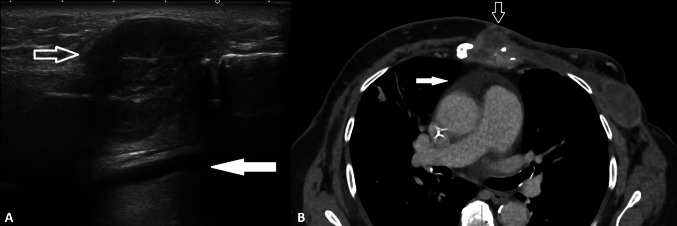 Fig. 15