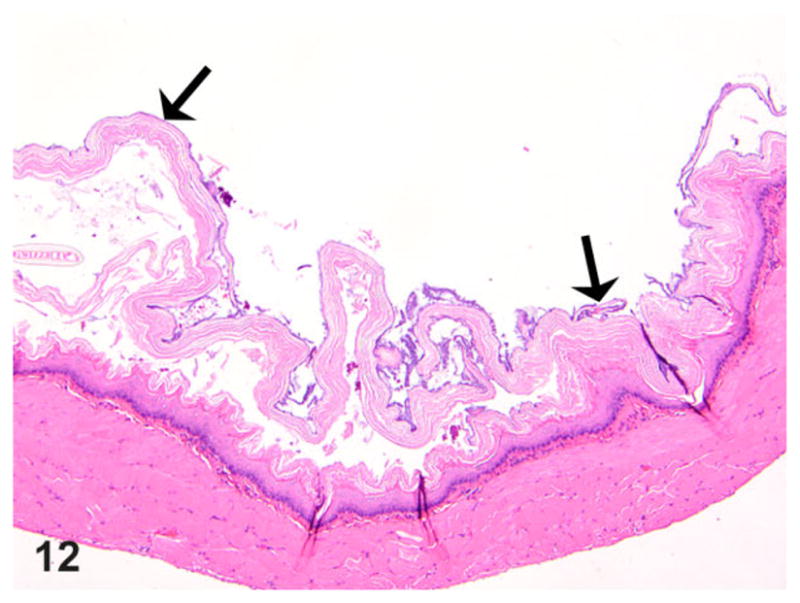 Figure 12