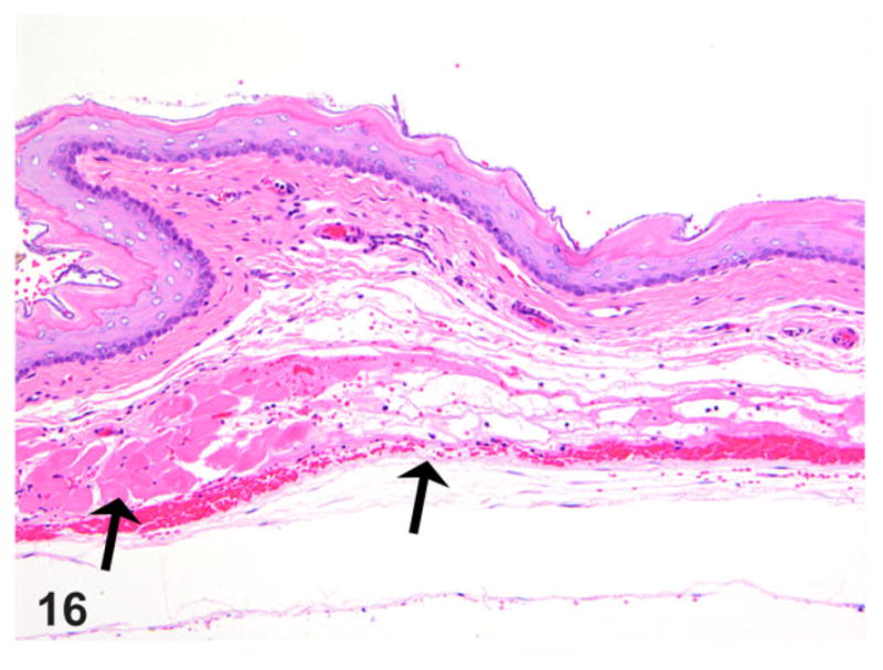 Figure 16